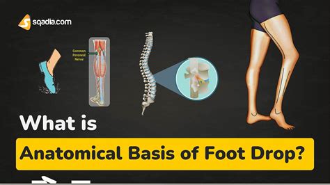 drop-tested to feet|anatomical basis of foot drop.